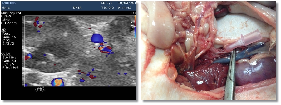 Shunt o Comunicación DXIA