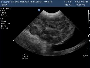 Primera Imagen Hígado DXIA Scott