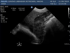 Revisión Imagen Hígado DXIA Scoot