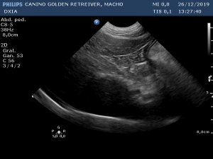 Última Imagen Hepática DXIA Scott